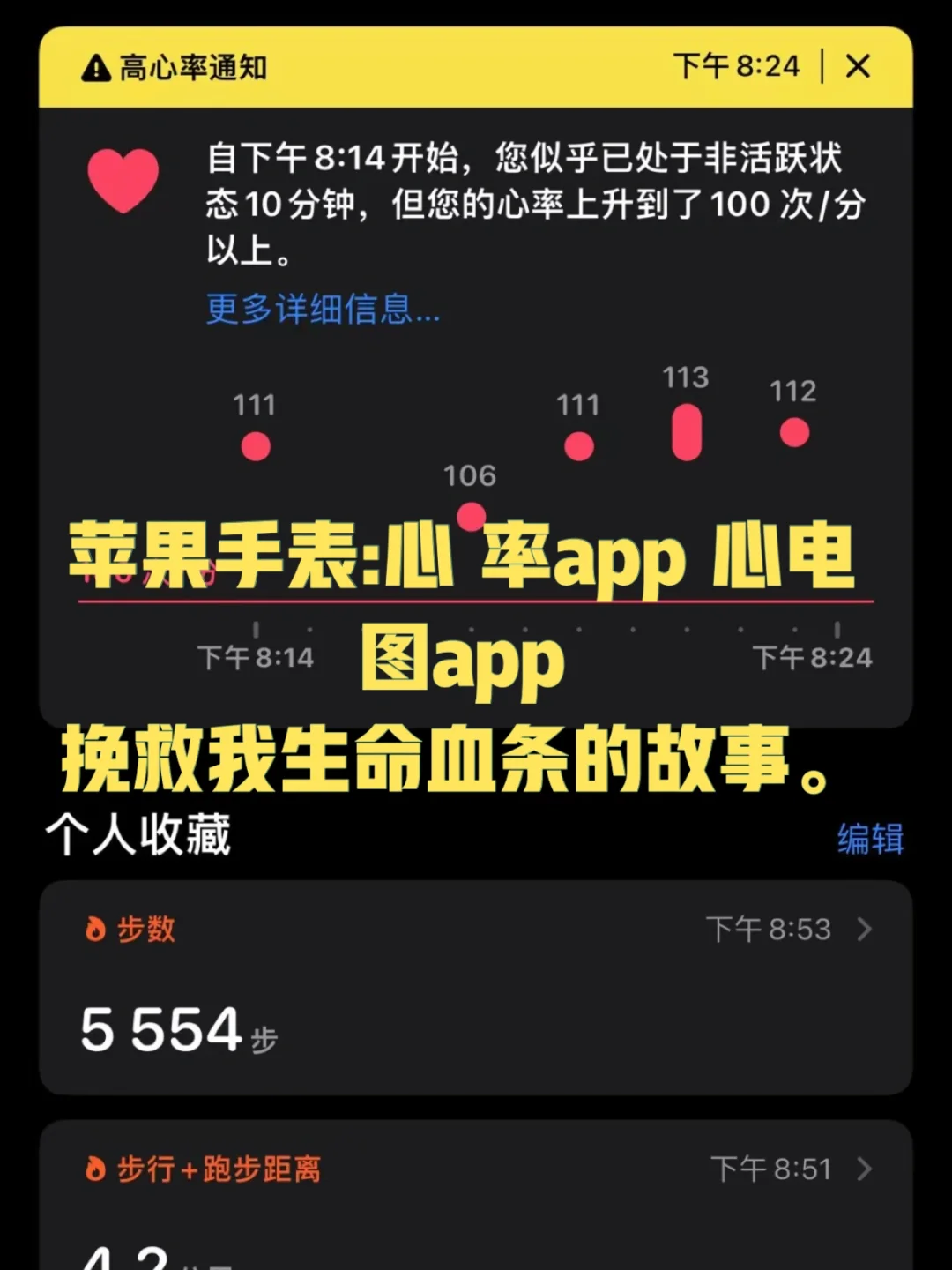 心电图客户端APP源码的简单介绍-第2张图片-太平洋在线下载